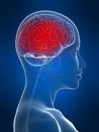 Blood pooled in brain, causing a migraine